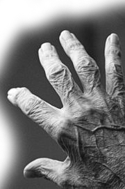 Elderly Hand - wikipedia